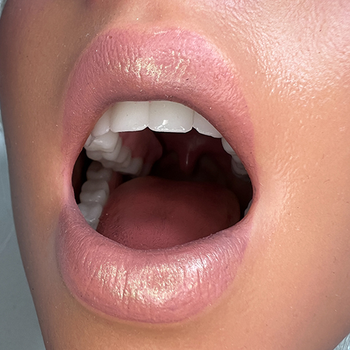 Other Silicone heads with ROS