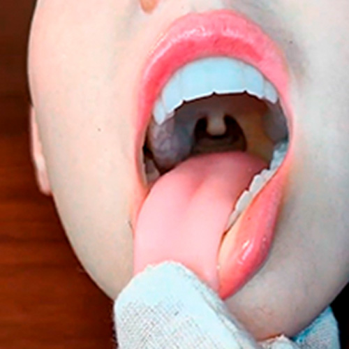 Kopf mit beweglichem Kiefer und ROS