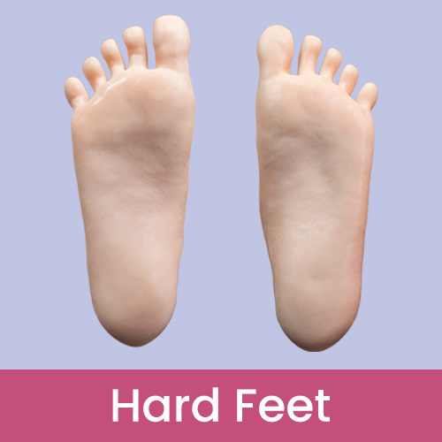 Hard feet - standing without bolts