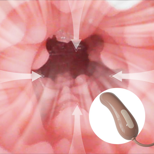 Oral suction [+€75]